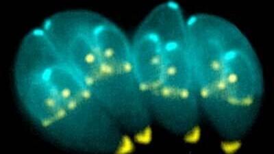 <i>Toxoplasma gondii.