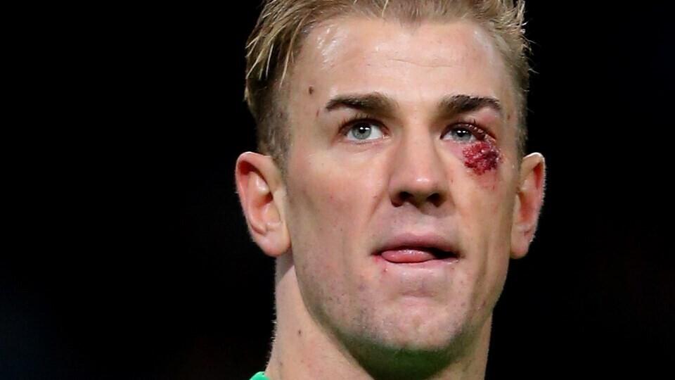 Joe Hart