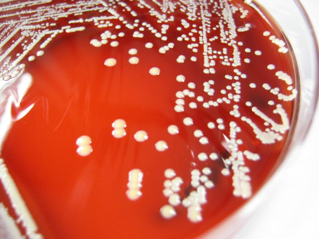 Staphylococcus lugdunensis ehk bakter, mis suudab toota antibiootikumi.