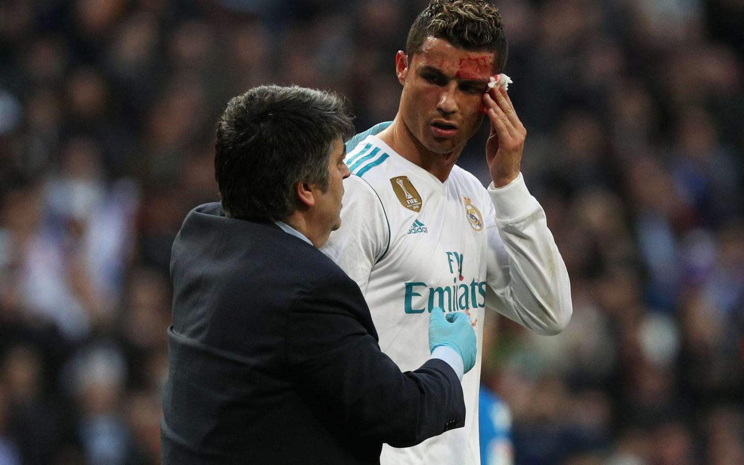 Cristiano Ronaldol löödi nägu veriseks.