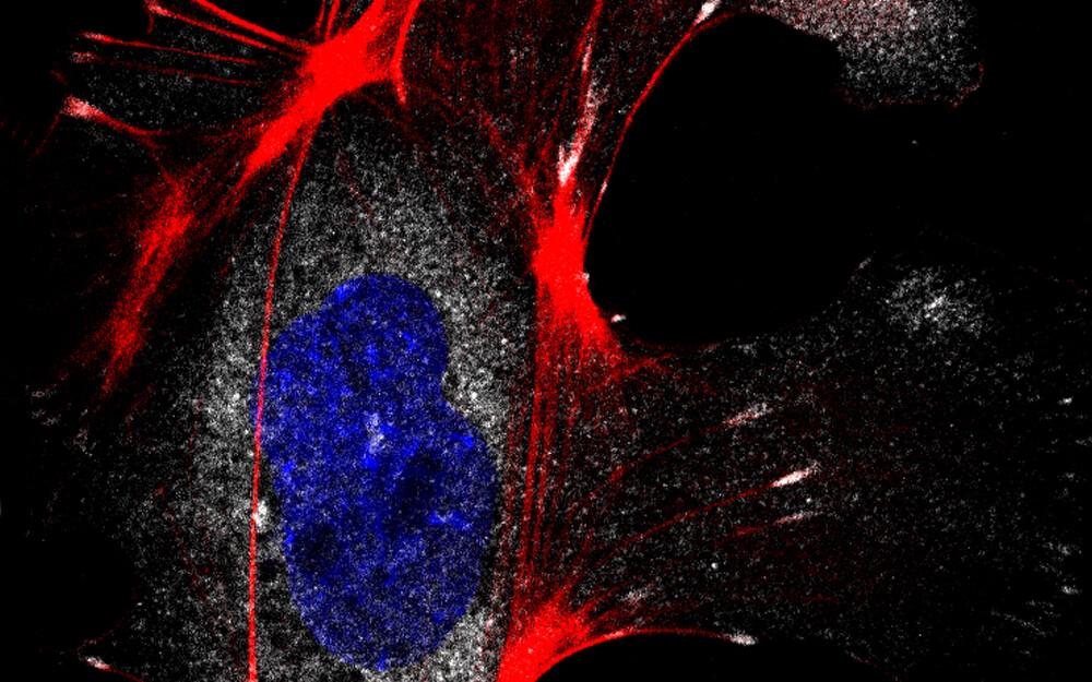 Hiire embrüonaalsed fibroblastid (MEF) E12,5 dpc. Tuumad värvitud DAPI-ga (sinine), fokaalse adhesiooni kompleksid värvitud vinkuliiniga (valge), F-aktiin värvitud värviga Phalloidin 594 (punane), konfokaalmikroskoop.