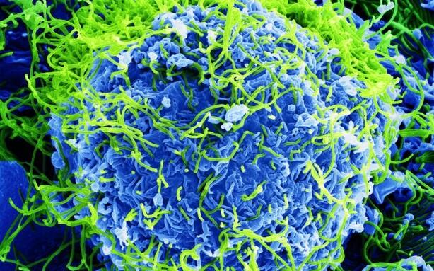 “Ilus… aga tappev” nii pealkirjastas oma elektronmikroskoobi pildi John Bernbaum USAst. Pildil on ebola viirusosake, mis võetud ahvi neerurakust.