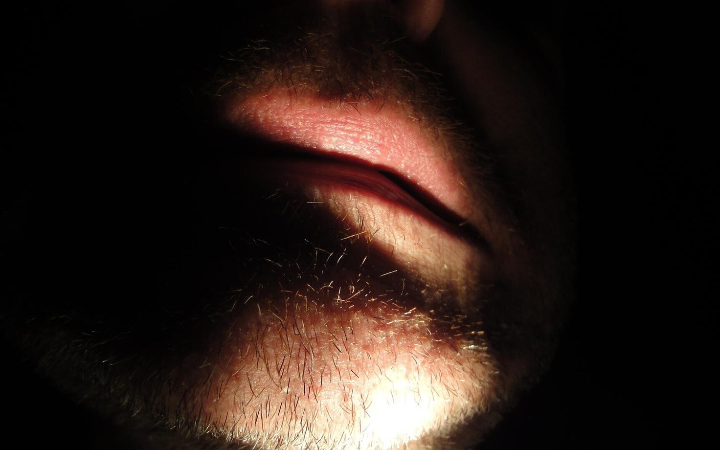 Один мужчина укусил другого. Иллюстративная фотография.